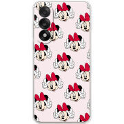 Чохол BoxFace OnePlus Nord 5 