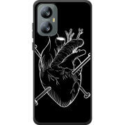 Чохол BoxFace Blackview A52 