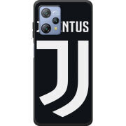 Чохол BoxFace Blackview A53 FC J