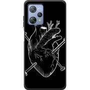 Чохол BoxFace Blackview A53 Pro 