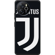 Чохол BoxFace Blackview Shark 8 FC J