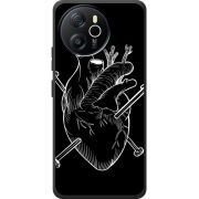 Чохол BoxFace Blackview Shark 8 