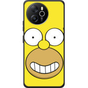 Чохол BoxFace Blackview Shark 8 