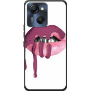 Чохол BoxFace Blackview Oscal Modern 8 