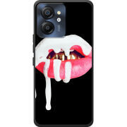 Чохол BoxFace Blackview Color 8 