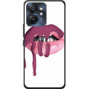 Чохол BoxFace Blackview Color 8 