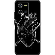 Чохол BoxFace Oukitel WP50 