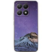 Чохол BoxFace Xiaomi 15T 