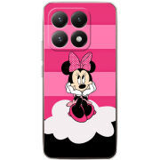 Чохол BoxFace Xiaomi 15T 