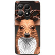 Чохол BoxFace Xiaomi 15T 