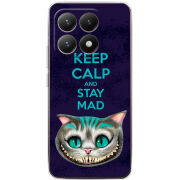 Чохол BoxFace Xiaomi 15T Stay Mad