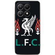 Чохол BoxFace Xiaomi 15T L. F. C.