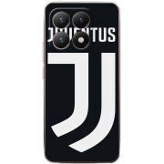 Чохол BoxFace Xiaomi 15T FC J