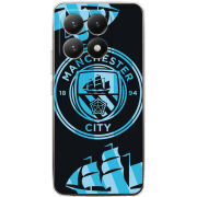 Чохол BoxFace Xiaomi 15T FC M-City