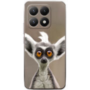 Чохол BoxFace Xiaomi 15T 