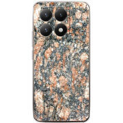 Чохол BoxFace Xiaomi 15T 