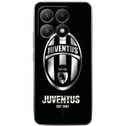 Чохол BoxFace Xiaomi 15T 