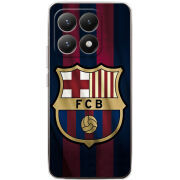 Чохол BoxFace Xiaomi 15T 