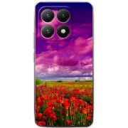 Чохол BoxFace Xiaomi 15T 