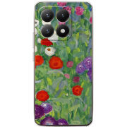 Чохол BoxFace Xiaomi 15T 