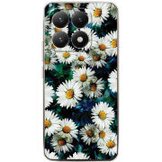 Чохол BoxFace Xiaomi 15T 