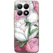 Чохол BoxFace Xiaomi 15T 