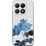 Чохол BoxFace Xiaomi 15T 