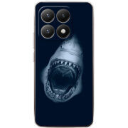 Чохол BoxFace Xiaomi 15T 