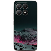 Чохол BoxFace Xiaomi 15T 