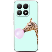 Чохол BoxFace Xiaomi 15T 