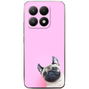 Чохол BoxFace Xiaomi 15T 