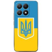 Чохол BoxFace Xiaomi 15T Герб України