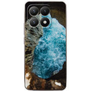 Чохол BoxFace Xiaomi 15T 