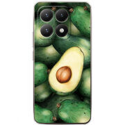 Чохол BoxFace Xiaomi 15T 