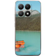 Чохол BoxFace Xiaomi 15T 