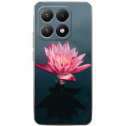 Чохол BoxFace Xiaomi 15T 