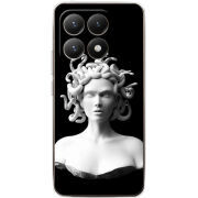 Чохол BoxFace Xiaomi 15T 