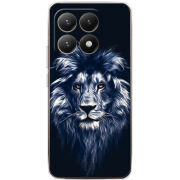 Чохол BoxFace Xiaomi 15T 