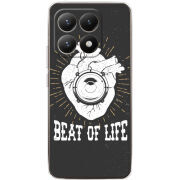 Чохол BoxFace Xiaomi 15T 