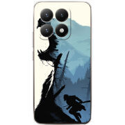 Чохол BoxFace Xiaomi 15T 