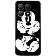 Чохол BoxFace Xiaomi 15T 