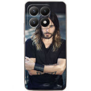 Чохол BoxFace Xiaomi 15T 