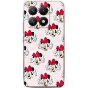 Чохол BoxFace Xiaomi 15T 