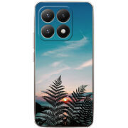 Чохол BoxFace Xiaomi 15T 