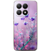 Чохол BoxFace Xiaomi 15T 