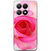 Чохол BoxFace Xiaomi 15T 