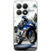 Чохол BoxFace Xiaomi 15T 