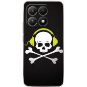 Чохол BoxFace Xiaomi 15T 