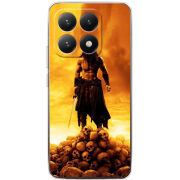 Чохол BoxFace Xiaomi 15T 