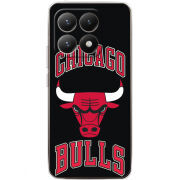 Чохол BoxFace Xiaomi 15T 